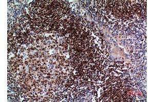 Immunohistochemistry (IHC) analysis of paraffin-embedded Human Tonsil, antibody was diluted at 1:100. (PAX5 antibody  (Internal Region))