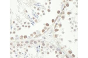 Immunohistochemistry (IHC) image for anti-Checkpoint Kinase 1 (CHEK1) (AA 250-300) antibody (ABIN7448476) (CHEK1 antibody  (AA 250-300))