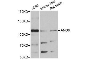 Western blot analysis of extracts of various cell lines, using ANO6 antibody (ABIN6291638) at 1:3000 dilution.