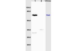 L1 mouse liver lysates L2 rat brain lysates probed with Anti Phospho-IRAK1 (Thr209) Polyclonal Antibody, Unconjugated (ABIN742658) at 1:200 overnight at 4 °C. (IRAK1 antibody  (pThr209))