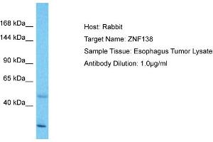 Host: Rabbit Target Name: ZNF138 Sample Type: Esophagus Tumor lysates Antibody Dilution: 1. (ZNF138 antibody  (Middle Region))