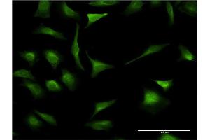 Immunofluorescence of monoclonal antibody to XBP1 on HeLa cell. (XBP1 antibody  (AA 123-225))