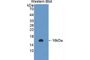 Figure. (NSP5 antibody  (AA 961-1063))