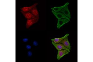 ABIN7094226 and ABIN7098273 staining Hela cells by IF/ICC. (FBXO7 antibody  (C-Term))
