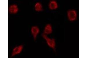 ABIN6275749 staining HuvEc by IF/ICC. (ZNF446 antibody  (Internal Region))