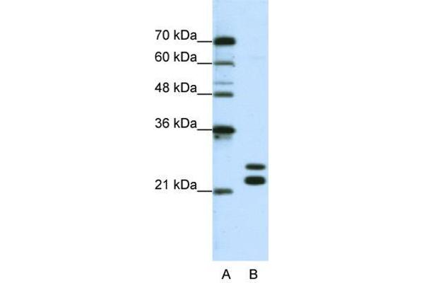 CSDC2 antibody  (N-Term)