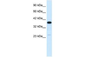 C4BPB antibody used at 1 ug/ml to detect target protein. (C4BPB antibody  (N-Term))