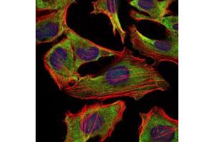 Immunofluorescence analysis of Hela cells using NEFL mouse mAb (green). (NEFL antibody)