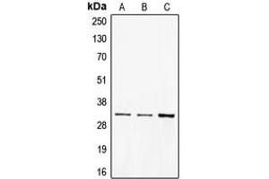 Western blot analysis of CD40 expression in BJAB (A), A431 (B), Ramos (C) whole cell lysates. (CD40 antibody  (C-Term))