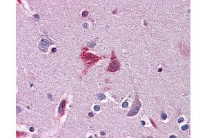 Anti-WDR20 antibody IHC of human brain, cortex. (WDR20 antibody  (AA 1-570))