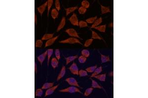 Immunofluorescence analysis of L929 cells using TRA antibody (ABIN7270871) at dilution of 1:100. (TRAPPC6A antibody  (AA 1-173))
