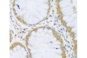 Immunohistochemistry (Paraffin-embedded Sections) (IHC (p)) image for anti-ADP Ribosylation Factor Like GTPase 6 (ARL6) antibody (ABIN7264305)