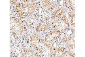 ABIN6266570 at 1/200 staining human kidney tissue sections by IHC-P. (KRT17 antibody  (C-Term))