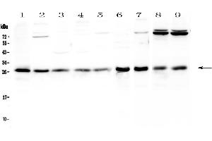 Western blot analysis of RAB27A using anti-RAB27A antibody . (RAB27A antibody  (AA 98-216))
