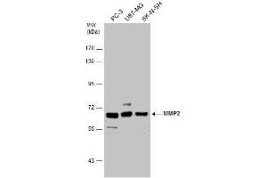 WB Image MMP2 antibody detects MMP2 protein by western blot analysis.