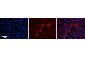 Rabbit Anti-C19orf10 Antibody  Catalog Number: ARP63969_P050 Formalin Fixed Paraffin Embedded Tissue: Human Adult Liver  Observed Staining: Cytoplasm in hepatocytes, moderate tissue distribution, resemble Golgi structures  Primary Antibody Concentration: 1:100 Secondary Antibody: Donkey anti-Rabbit-Cy3 Secondary Antibody Concentration: 1:200 Magnification: 20X Exposure Time: 0. (C19orf10 antibody  (Middle Region))