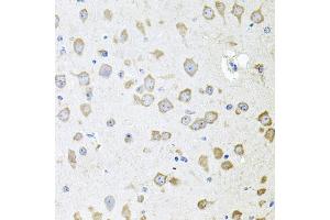 Immunohistochemistry of paraffin-embedded mouse brain using  antibody (ABIN6129179, ABIN6136708, ABIN6136710 and ABIN6222176) at dilution of 1:100 (40x lens). (AKAP5 antibody  (AA 1-270))