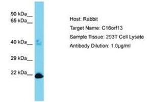 Image no. 1 for anti-Chromosome 16 Open Reading Frame 13 (C16ORF13) (AA 50-99) antibody (ABIN6750484) (C16ORF13 antibody  (AA 50-99))