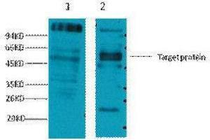 Western Blotting (WB) image for anti-Fc Fragment of IgE, Low Affinity II, Receptor For (CD23) (FCER2) antibody (ABIN3178635) (FCER2 antibody)