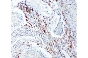 Immunohistochemistry (IHC) image for anti-SHC (Src Homology 2 Domain Containing) Transforming Protein 1 (SHC1) (C-Term) antibody (ABIN3032555)
