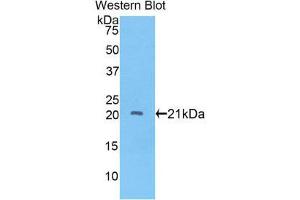 Western Blotting (WB) image for anti-ADAM Metallopeptidase with thrombospondin Type 1 Motif, 12 (ADAMTS12) (AA 827-1001) antibody (ABIN1857901)