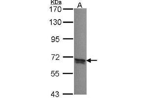 WB Image Sample (30 ug of whole cell lysate) A: A431 , 7. (PPP2R5B antibody  (C-Term))