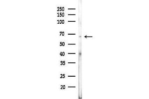 anti-Keratin 84 (KRT84) (C-Term) antibody