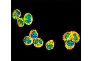 IF testing of AKT1 antibody with MDA-MB435 cells followed by Alexa Fluor 488-conjugated goat anti-rabbit lgG (green). (AKT1 antibody  (AA 115-144))