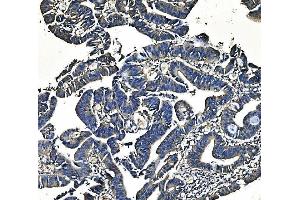 IHC analysis of PCK2 using anti-PCK2 antibody (ABIN7599509).