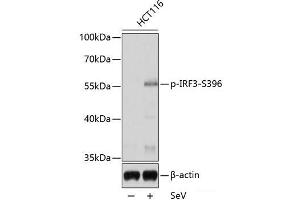Western blot analysis of extracts of HCT116 cells using Phospho-IRF3(S396) Polyclonal Antibody at dilution of 1:1000. (IRF3 antibody  (pSer396))