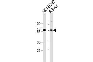 Western Blotting (WB) image for anti-Methylcrotonoyl-CoA Carboxylase 2 (Beta) (MCCC2) antibody (ABIN3002883) (MCCC2 antibody)