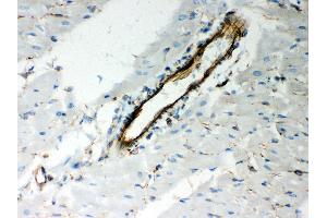Anti- Vimentin Picoband antibody, IHC(P) IHC(P): Rat Cardiac Muscle Tissue (Vimentin antibody  (C-Term))