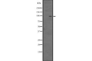 Western blot analysis of BCL11B expression in Jurkat cell lysate,The lane on the left is treated with the antigen-specific peptide. (BCL11B antibody  (Internal Region))