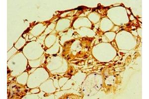 Immunohistochemistry of paraffin-embedded human trachea tissue using ABIN7168119 at dilution of 1:100 (POP7 antibody  (AA 1-140))