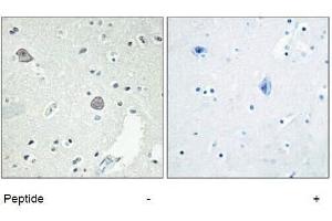 Immunohistochemical analysis of paraffin-embedded Human-Brian , antibody was diluted at 1:100. (D1DR antibody  (Internal Region))