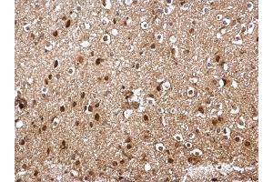 IHC-P Image SKP1 antibody detects SKP1 protein at cytosol and nucleus on mouse middle brain by immunohistochemical analysis.