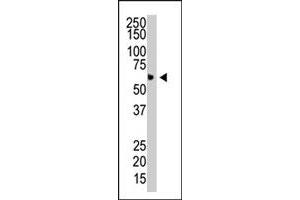 The PIAS4 polyclonal antibody  is used in Western blot to detect PIAS4 in HL-60 cell lysate.