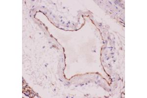 Anti-ACE Picoband antibody,  IHC(P): Rat Lung Tissue (Angiotensin I Converting Enzyme 1 antibody  (AA 651-864))