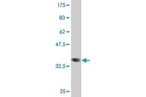 Western Blot detection against Immunogen (37. (PSMD4/ASF antibody  (AA 1-110))