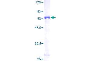 TPM2 Protein (AA 1-284) (GST tag)