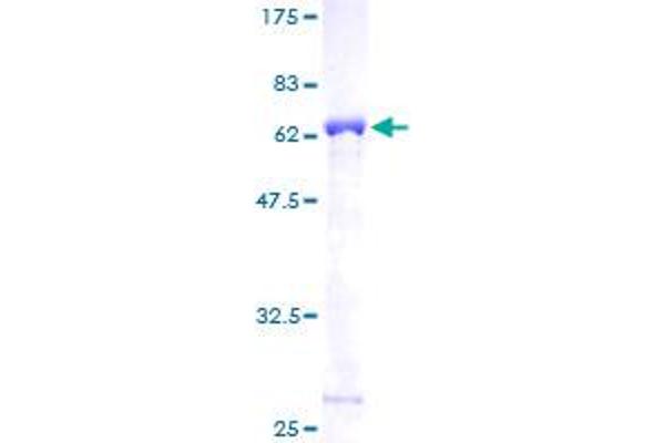 TPM2 Protein (AA 1-284) (GST tag)