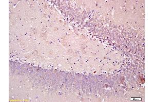 Formalin-fixed and paraffin embedded rat brain tissue labeled with Anti-SEMA4F Polyclonal Antibody, Unconjugated (ABIN1385844) at 1:200, followed by conjugation to the secondary antibody and DAB staining