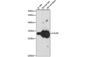 Western blot analysis of extracts of various cell lines, using CALB1 antibody. (CALB1 antibody)