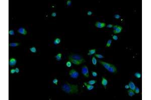 Image provided by One World Lab validation initiative. (LAMP1 antibody  (AA 301-417))