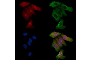 ABIN6257708 and ABIN6275404 staining Hela cells by IF/ICC.