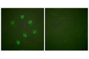 Immunofluorescence analysis of COS7 cells, using Ki67antibody. (Ki-67 antibody  (C-Term))