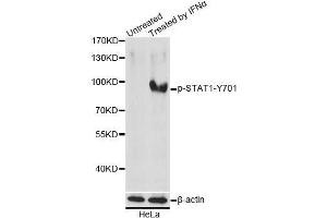 Western blot analysis of extracts of HeLa cells, using Phospho-STAT1-Y701 antibody (ABIN2987401) at 1/1000 dilution. (STAT1 antibody  (pTyr701))