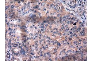 Image no. 2 for anti-Keratin 18 (KRT18) (AA 69-372) antibody (ABIN1491639) (Cytokeratin 18 antibody  (AA 69-372))
