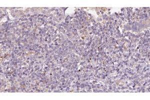 STT3B antibody  (C-Term)