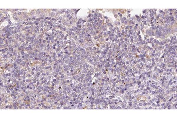 STT3B antibody  (C-Term)